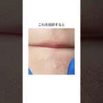 まずはこのクレンジングから始めてみて😘#肌＃垢抜けたい女子＃毛穴＃毛穴ケア＃ニキビ #ニキビケア #pr #クレンジング #いちご鼻 #垢抜け